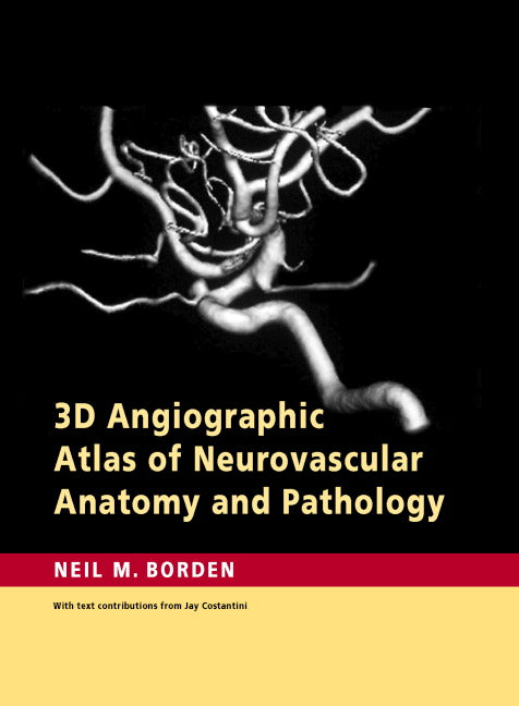 3D Angiographic Atlas of Neurovascular Anatomy and Pathology (Hardback) 9780521856843