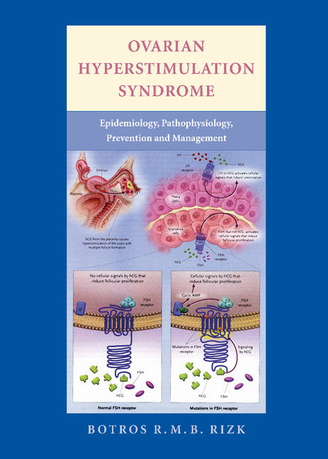 Ovarian Hyperstimulation Syndrome; Epidemiology, Pathophysiology, Prevention and Management (Hardback) 9780521857987