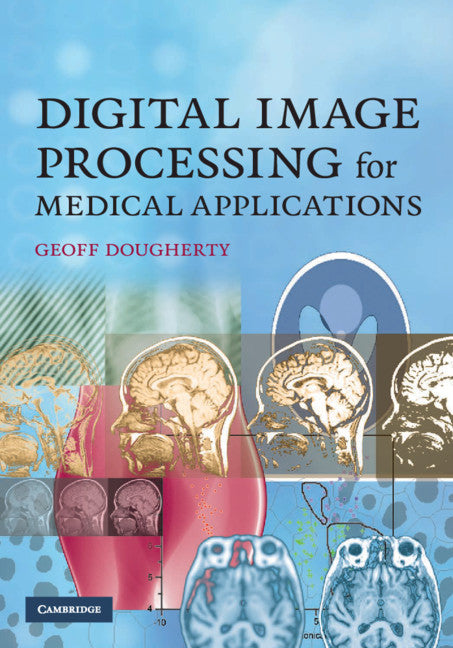 Digital Image Processing for Medical Applications (Hardback) 9780521860857