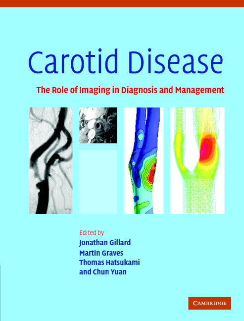 Carotid Disease; The Role of Imaging in Diagnosis and Management (Hardback) 9780521862264