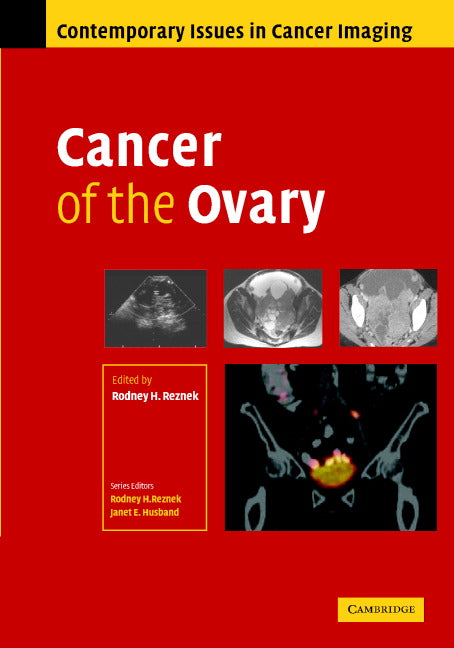 Cancer of the Ovary (Hardback) 9780521863230