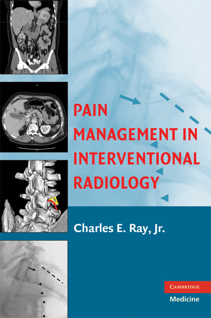 Pain Management in Interventional Radiology (Hardback) 9780521865920