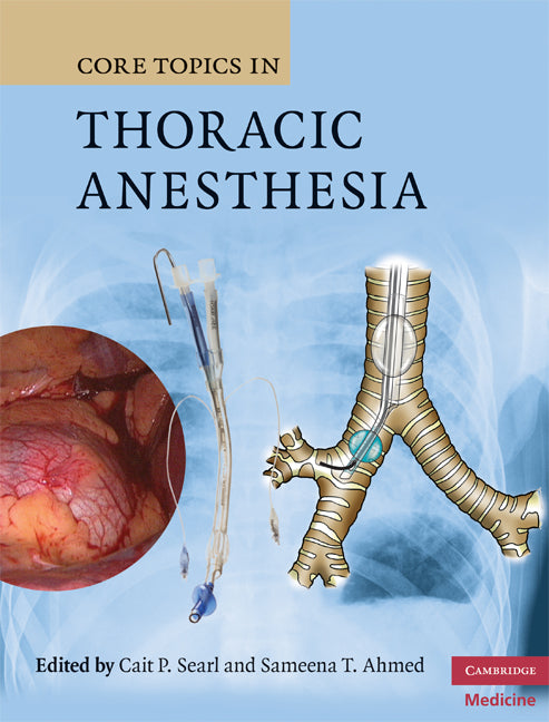 Core Topics in Thoracic Anesthesia (Hardback) 9780521867122