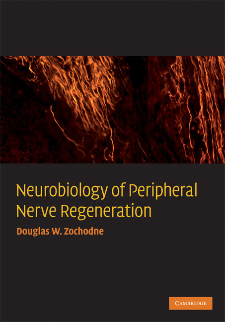 Neurobiology of Peripheral Nerve Regeneration (Hardback) 9780521867177