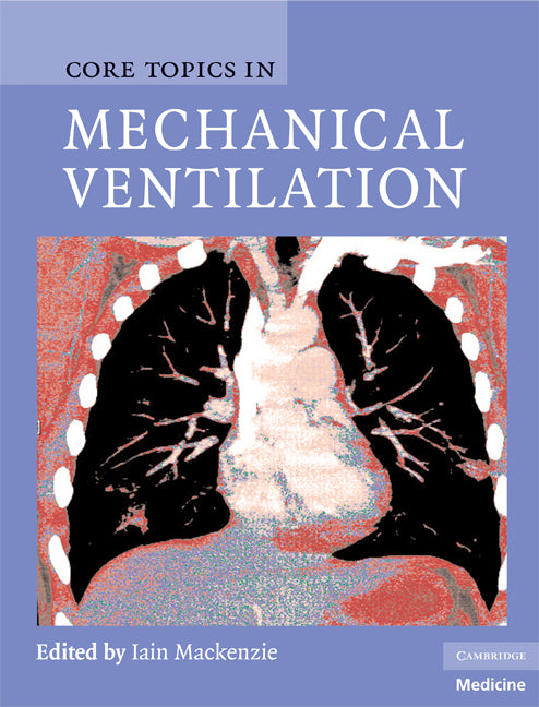 Core Topics in Mechanical Ventilation (Hardback) 9780521867818