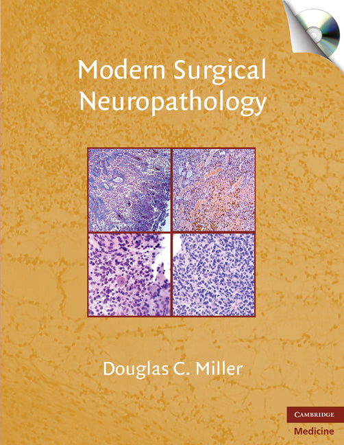 Modern Surgical Neuropathology with CD-ROM () 9780521869324