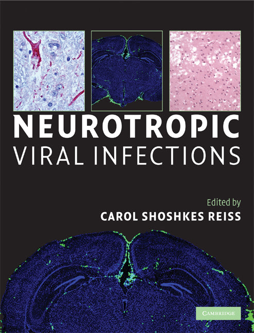 Neurotropic Viral Infections (Hardback) 9780521869645