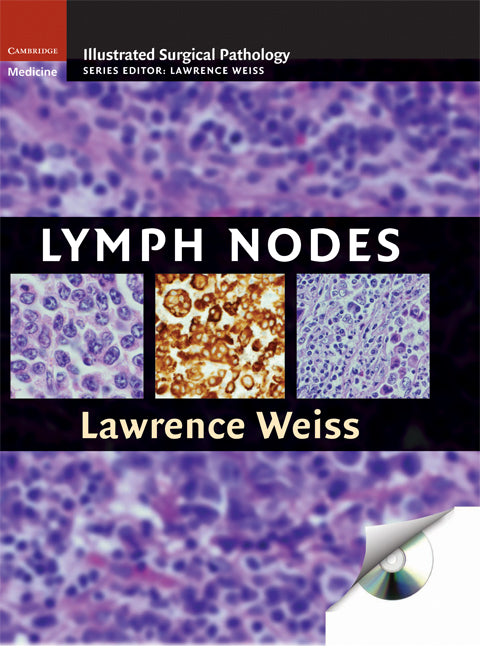 Lymph Nodes (Hardback) 9780521871617