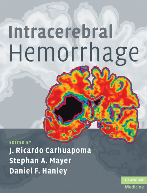 Intracerebral Hemorrhage (Hardback) 9780521873314