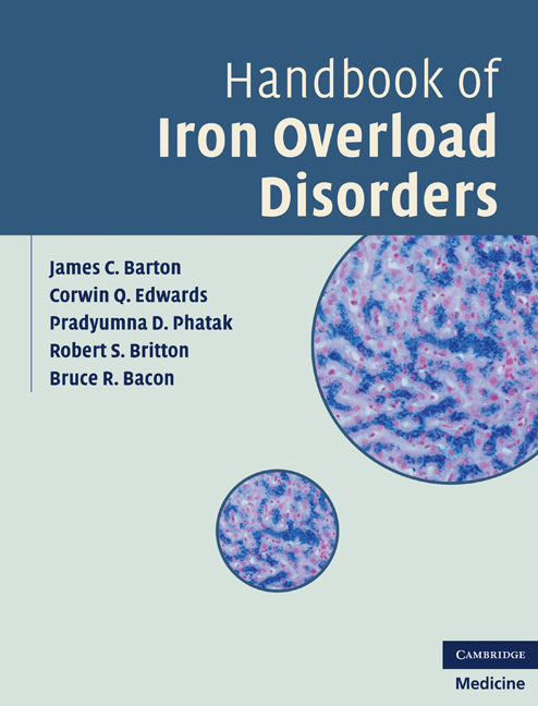 Handbook of Iron Overload Disorders (Hardback) 9780521873437