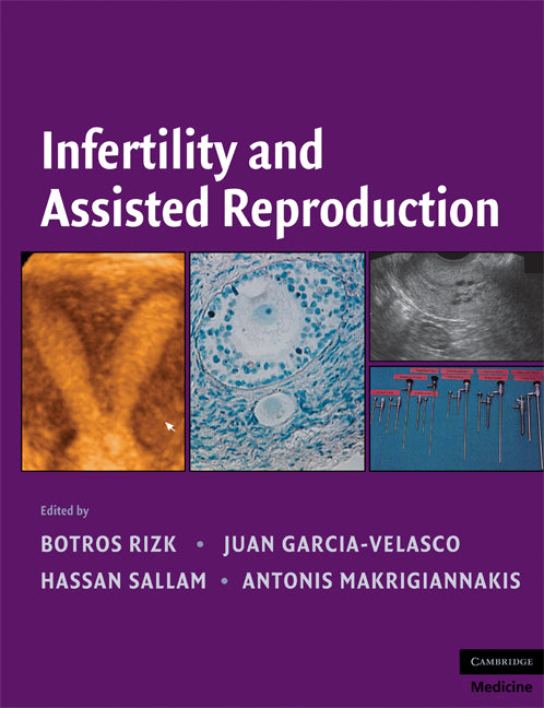 Infertility and Assisted Reproduction (Hardback) 9780521873796