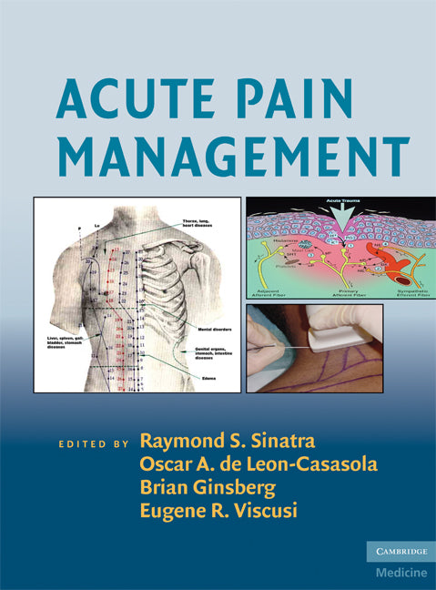 Acute Pain Management (Hardback) 9780521874915