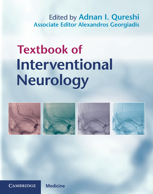 Textbook of Interventional Neurology (Hardback) 9780521876391