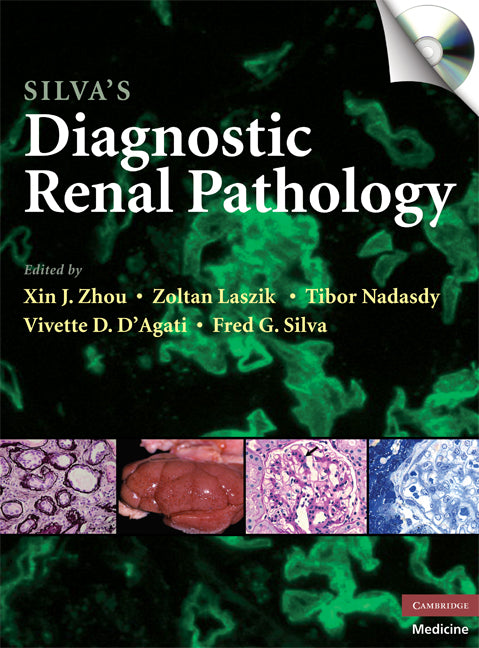 Silva's Diagnostic Renal Pathology () 9780521877022