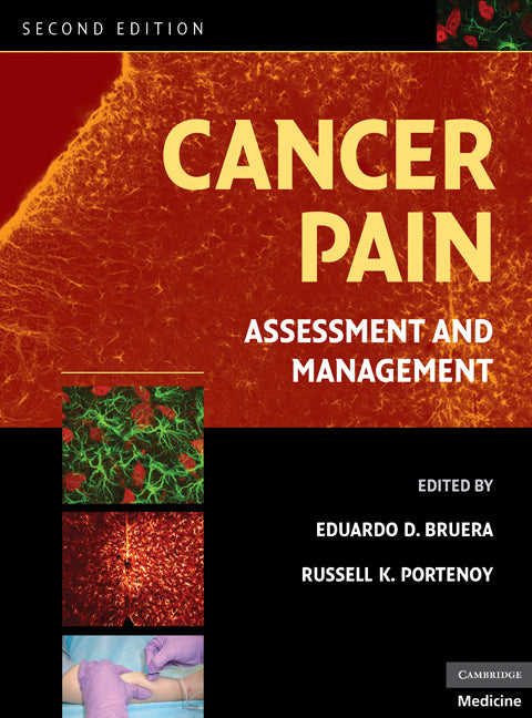 Cancer Pain; Assessment and Management (Hardback) 9780521879279