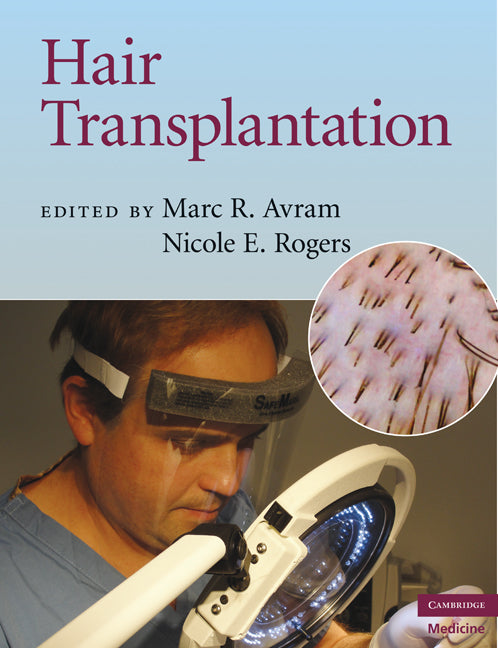 Hair Transplantation (Hardback) 9780521879675