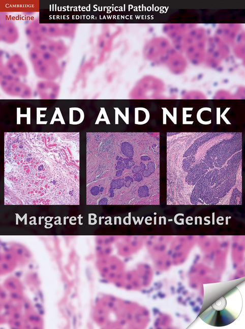 Head and Neck () 9780521879996