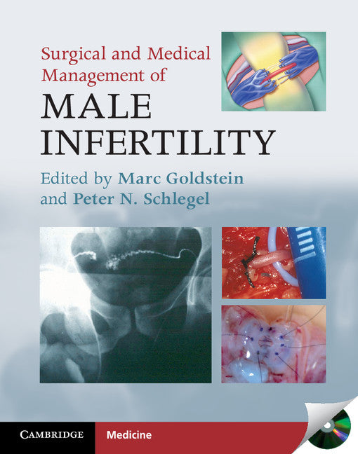 Surgical and Medical Management of Male Infertility (Hardback) 9780521881098