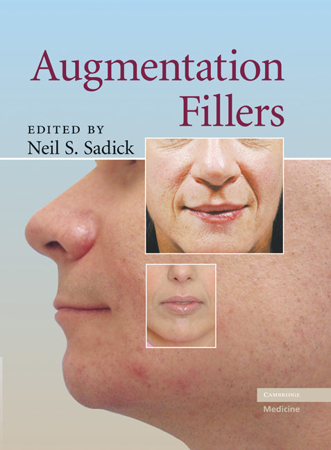 Augmentation Fillers (Hardback) 9780521881128