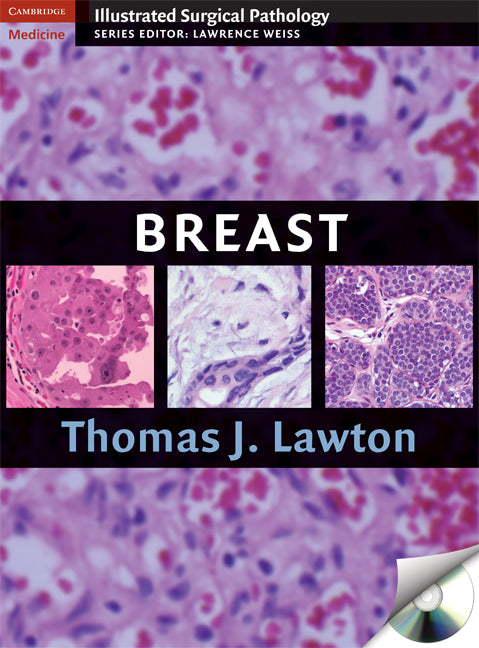 Breast (Hardback) 9780521881593