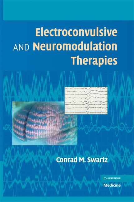 Electroconvulsive and Neuromodulation Therapies (Hardback) 9780521883887