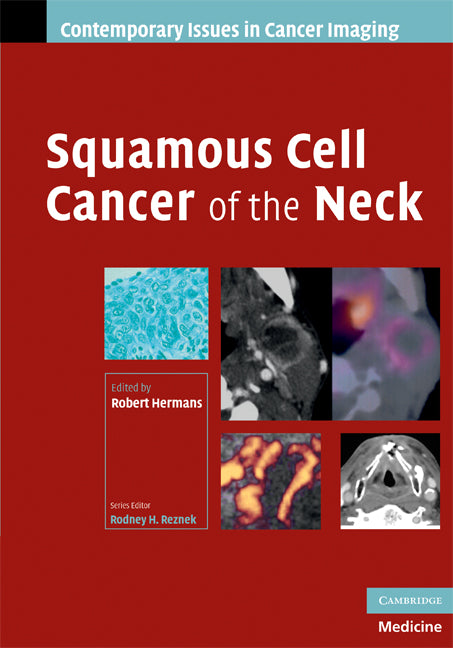 Squamous Cell Cancer of the Neck (Hardback) 9780521886918