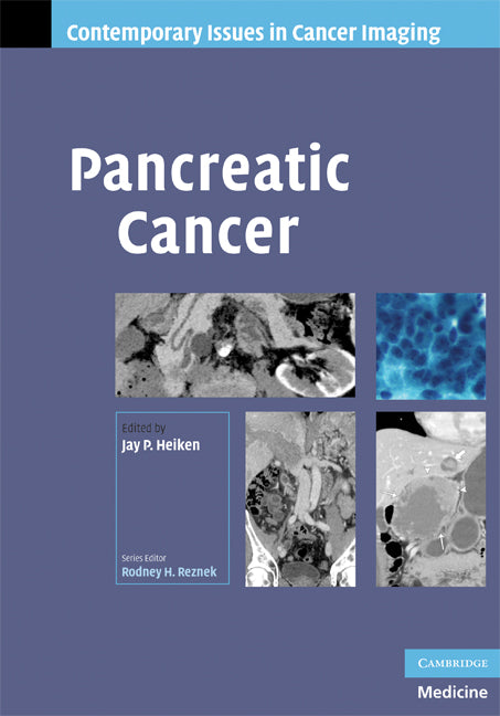 Pancreatic Cancer (Hardback) 9780521886925