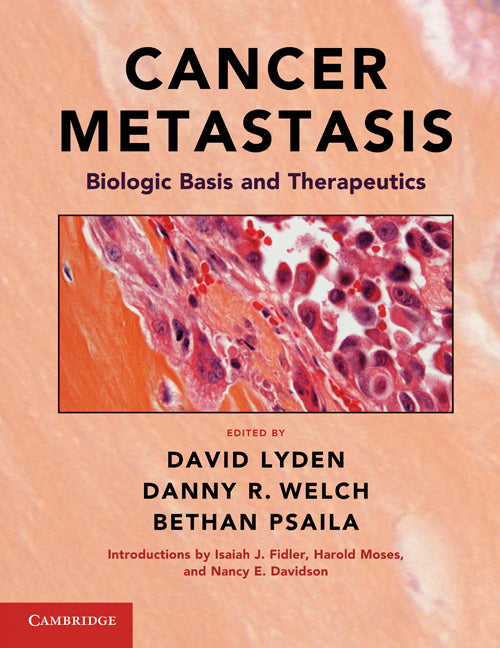 Cancer Metastasis; Biologic Basis and Therapeutics (Hardback) 9780521887212