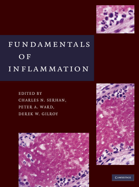 Fundamentals of Inflammation (Hardback) 9780521887298