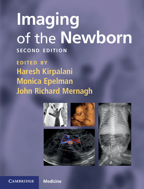 Imaging of the Newborn (Hardback) 9780521896269