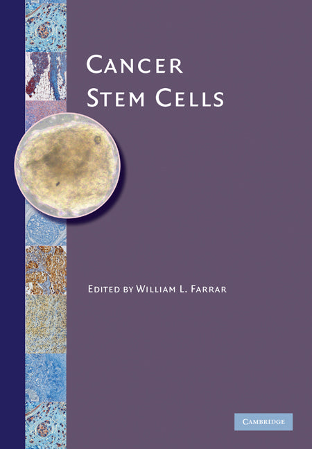 Cancer Stem Cells (Hardback) 9780521896283