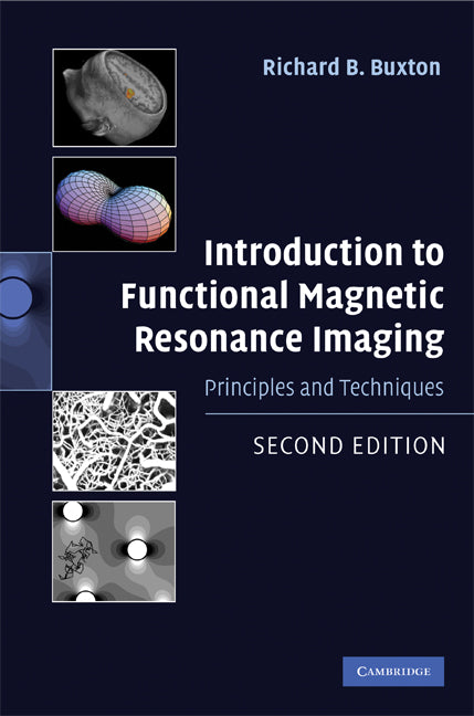 Introduction to Functional Magnetic Resonance Imaging; Principles and Techniques (Hardback) 9780521899956