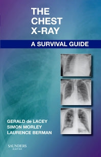 The Chest X-Ray: A Survival Guide (Paperback) 9780702030468