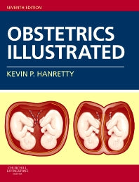 Obstetrics Illustrated (Paperback) 9780702030666