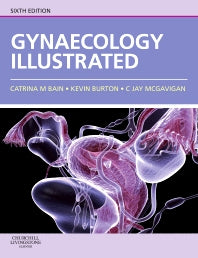 Gynaecology Illustrated (Paperback) 9780702030673