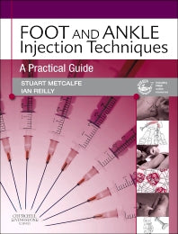 Foot and Ankle Injection Techniques; A Practical Guide (Hardback) 9780702031076