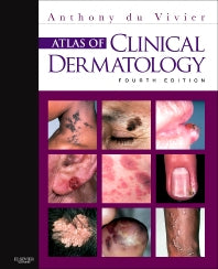 Atlas of Clinical Dermatology (Hardback) 9780702034213