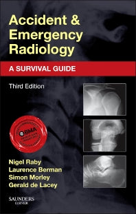 Accident and Emergency Radiology: A Survival Guide (Paperback) 9780702042324