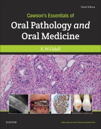 Cawson's Essentials of Oral Pathology and Oral Medicine (Paperback) 9780702049828