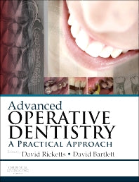 Advanced Operative Dentistry; A Practical Approach (Paperback) 9780702055386