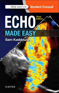 Echo Made Easy (Paperback) 9780702066566