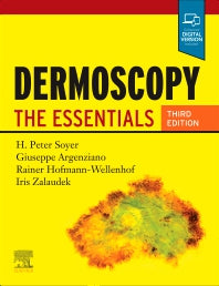 Dermoscopy; The Essentials (Paperback) 9780702068829