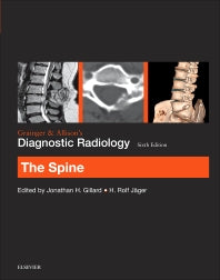 Grainger & Allison’s Diagnostic Radiology: The Spine (Paperback) 9780702069345