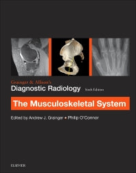 Grainger & Allison’s Diagnostic Radiology: Musculoskeletal System (Paperback) 9780702069369