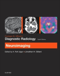 Grainger & Allison’s Diagnostic Radiology: Neuroimaging (Paperback) 9780702069376