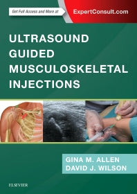 Ultrasound Guided Musculoskeletal Injections (Hardback) 9780702073144