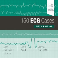 150 ECG Cases (Paperback) 9780702074585