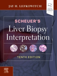 Scheuer's Liver Biopsy Interpretation (Hardback) 9780702075841