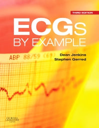 ECGs by Example (Paperback) 9780702077210