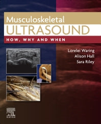 Musculoskeletal Ultrasound; How, Why and When (Hardback) 9780702081989